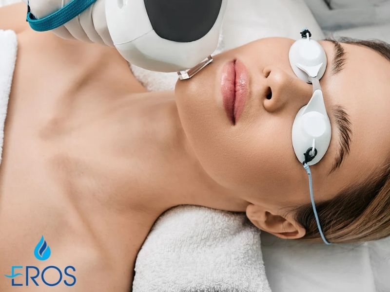 Công nghệ trị nám bằng laser Intense Pulsed Light (IPL) có thời gian điều trị khá nhanh