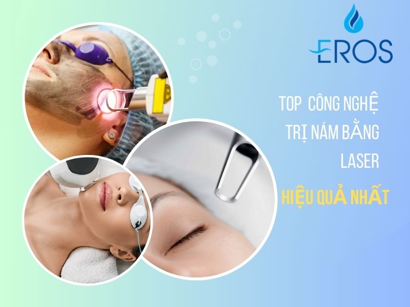 trị nám bằng laser